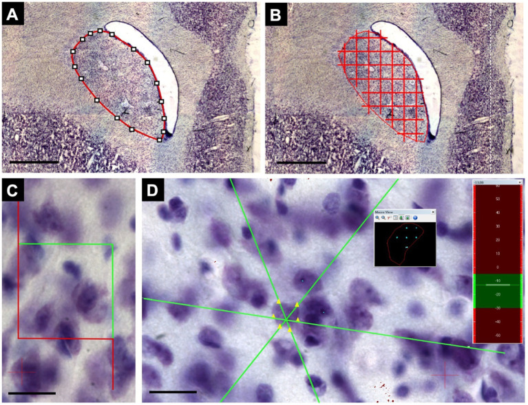 Ayahuasca partially preserves striatal integrity in juvenile non-human primates exposed to chronic stress: evidence from stereological evaluation.