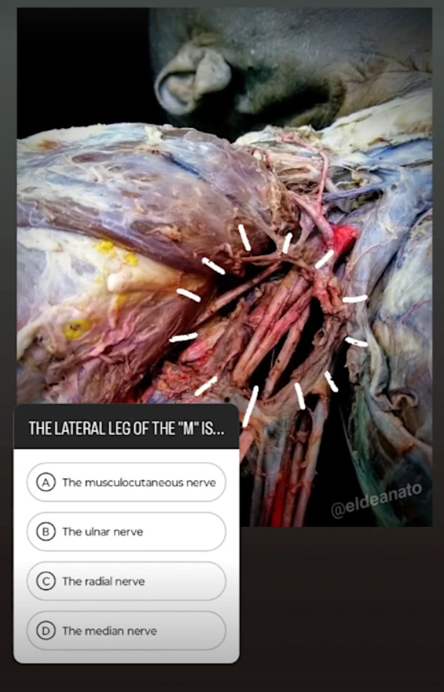 Web Analytics to Objectively Measure the Success of Educational Resources in Human Anatomy.