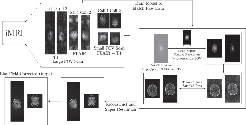 Deep learning-based Intraoperative MRI reconstruction.