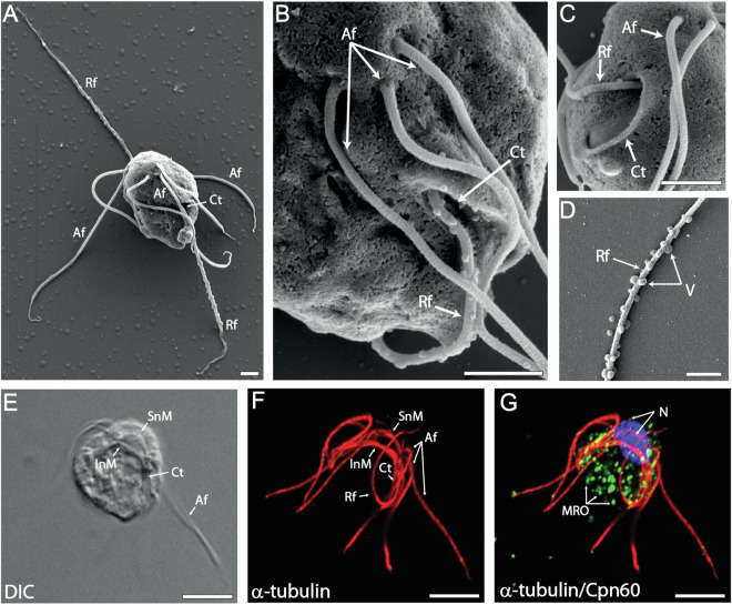 The expanded genome of Hexamita inflata, a free-living diplomonad.