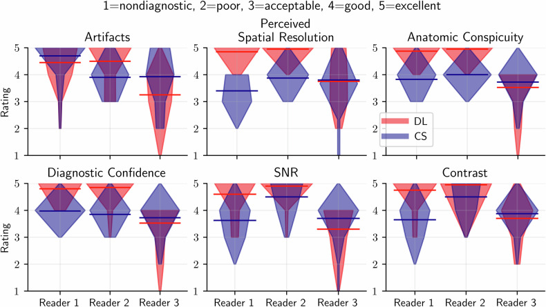 Deep learning-based Intraoperative MRI reconstruction.