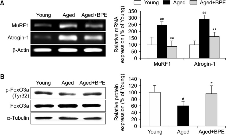 Standardized Fingerroot (<i>Boesenbergia pandurata</i>) Extract Decelerates the Development of Sarcopenia in Aged Rats.