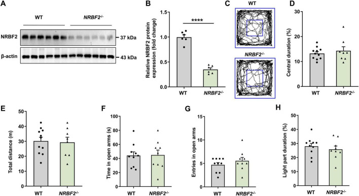 NRBF2 plays a crucial role in the acquisition process of learning and memory, independent of the Vps34 complex.
