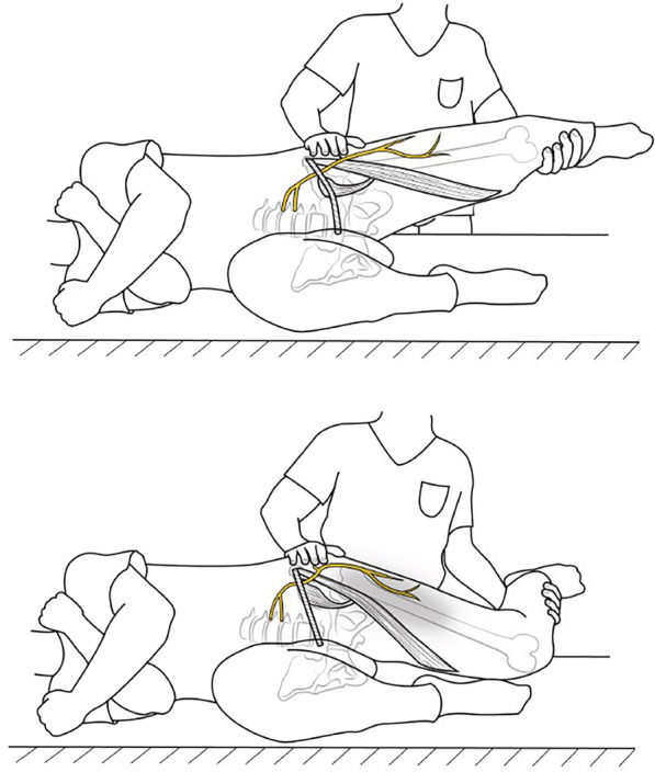 The Diagnosis and Management of Meralgia Paresthetica: A Narrative Review.