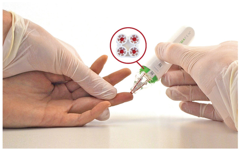 Evaluation of SARS-CoV-2 Antibody Response Between Paired Fingerprick (HemaPEN<sup>®</sup>) and Venepuncture Collected Samples in Children and Adults.