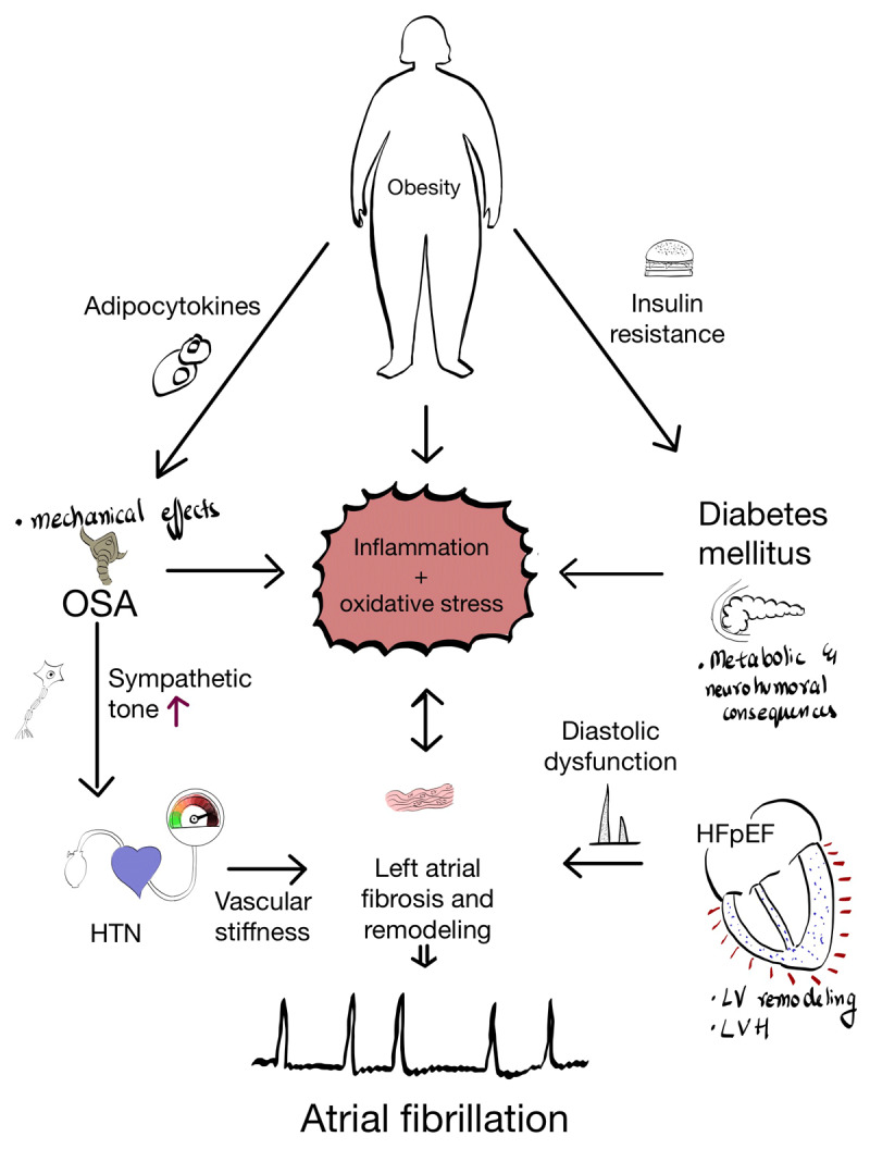 Obesity and Atrial Fibrillation: A Comprehensive Review.