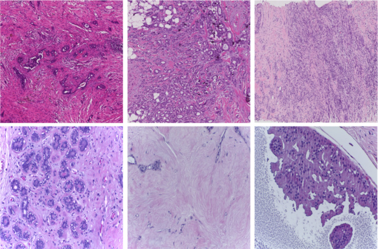 Deeply supervised two stage generative adversarial network for stain normalization.