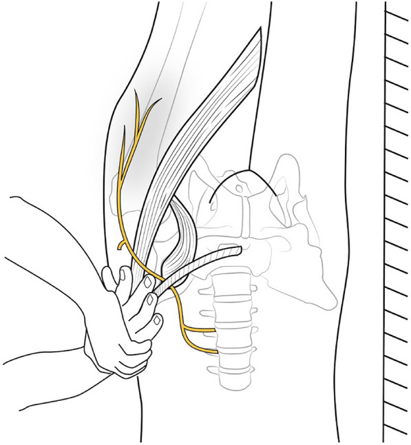 The Diagnosis and Management of Meralgia Paresthetica: A Narrative Review.
