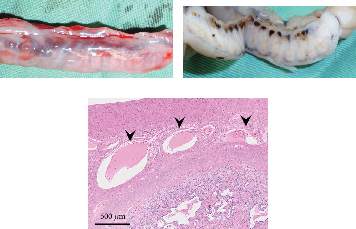 First Report of Hematosalpinx in a Cat With a Large Hematoma and Severe Anemia.