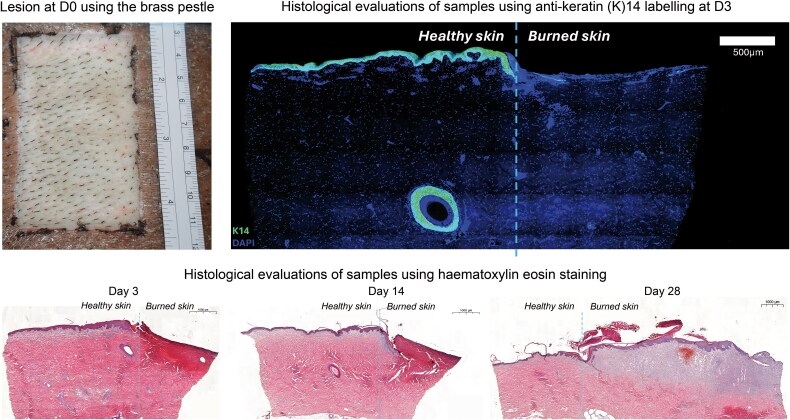 An easy and reproducible method for a large-zone deep partial-thickness burn model in the mini-pig.