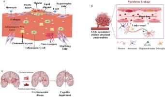 A noval neuro-biomarker of cognitive impairment related to cerebral small vessel disease in patients with T2DM: Lenticulostriate arteries