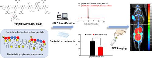 A novel Al18F-labelled NOTA-modified ubiquicidin 29-41 derivative as a bacterial infection PET imaging agent