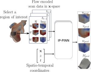 Input parameterized physics informed neural networks for de noising, super-resolution, and imaging artifact mitigation in time resolved three dimensional phase-contrast magnetic resonance imaging