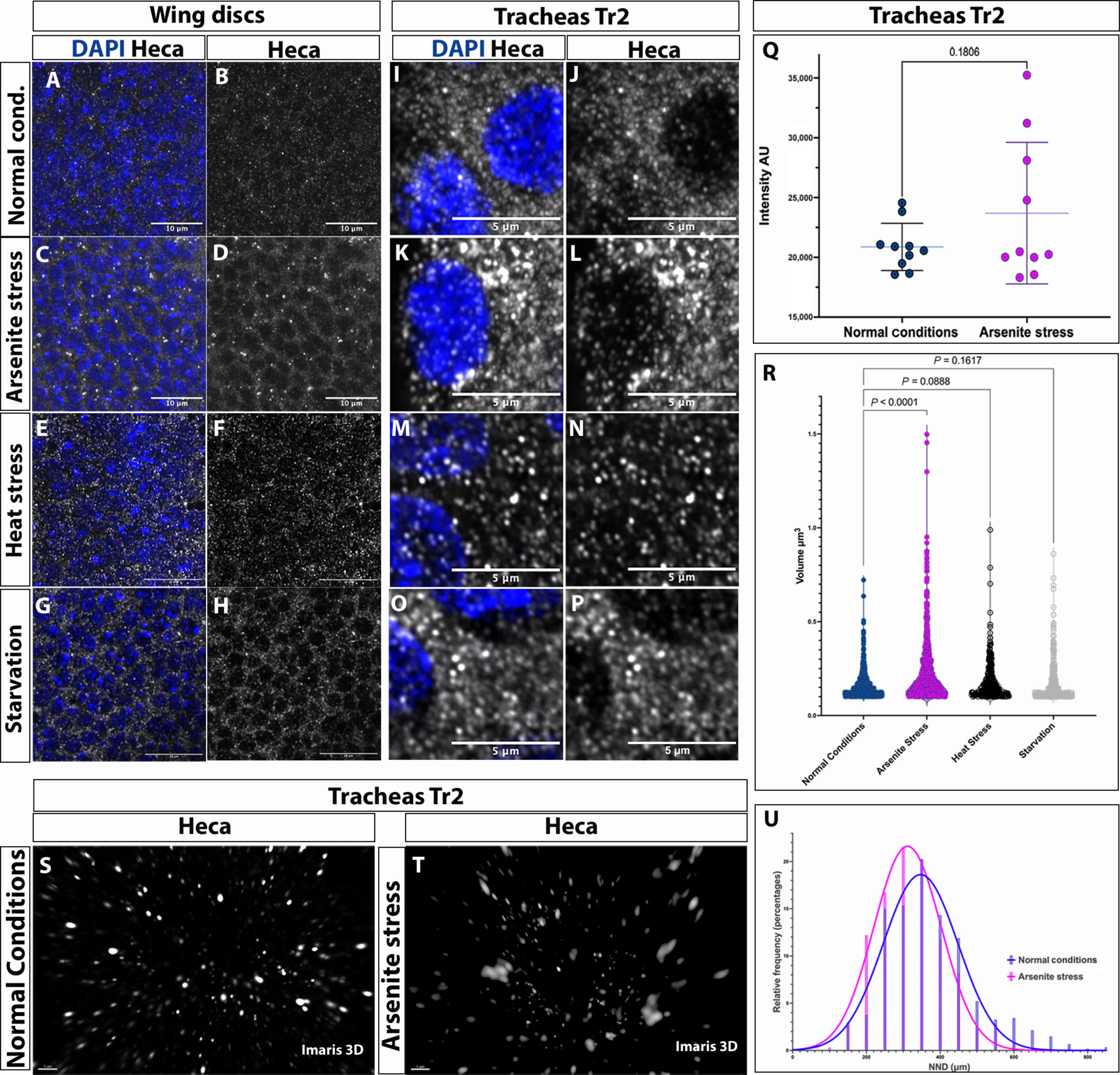 Drosophila and human Headcase define a new family of ribonucleotide granule proteins required for stress response