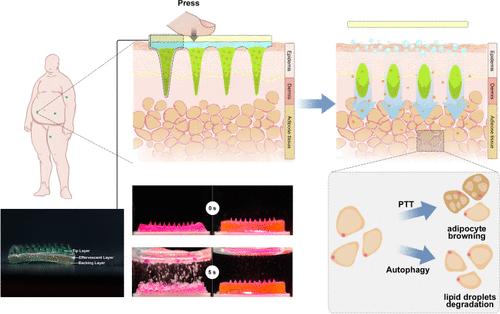 Effervescent Microneedles for the Codelivery of Chitosan Nanoparticles and Indocyanine Green To Enhance the Treatment of Diet-Induced Obesity in Mice