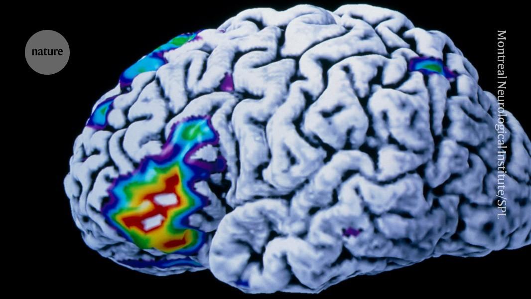 Brain implant translates thoughts to speech in an instant