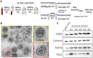 Transcriptome profiling of serum exosomes by RNA-Seq reveals lipid metabolic changes as a potential biomarker for evaluation of roxadustat treatment of chronic kidney diseases