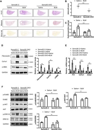 Semaphorin 3E–Plexin D1 Axis Drives Lung Fibrosis through ErbB2-Mediated Fibroblast Activation