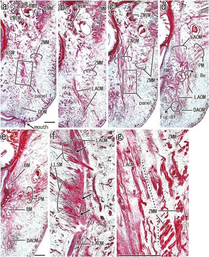 Correction to “[Growth patterns of facial muscles at the angle of the mouth: A histological study using midterm and near-term human fetuses]”