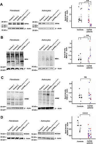 Fibroblasts and hiPS-Derived Astrocytes From CoPAN Patients Showed Different Levels of Iron Overload Correlated With Senescent Phenotype