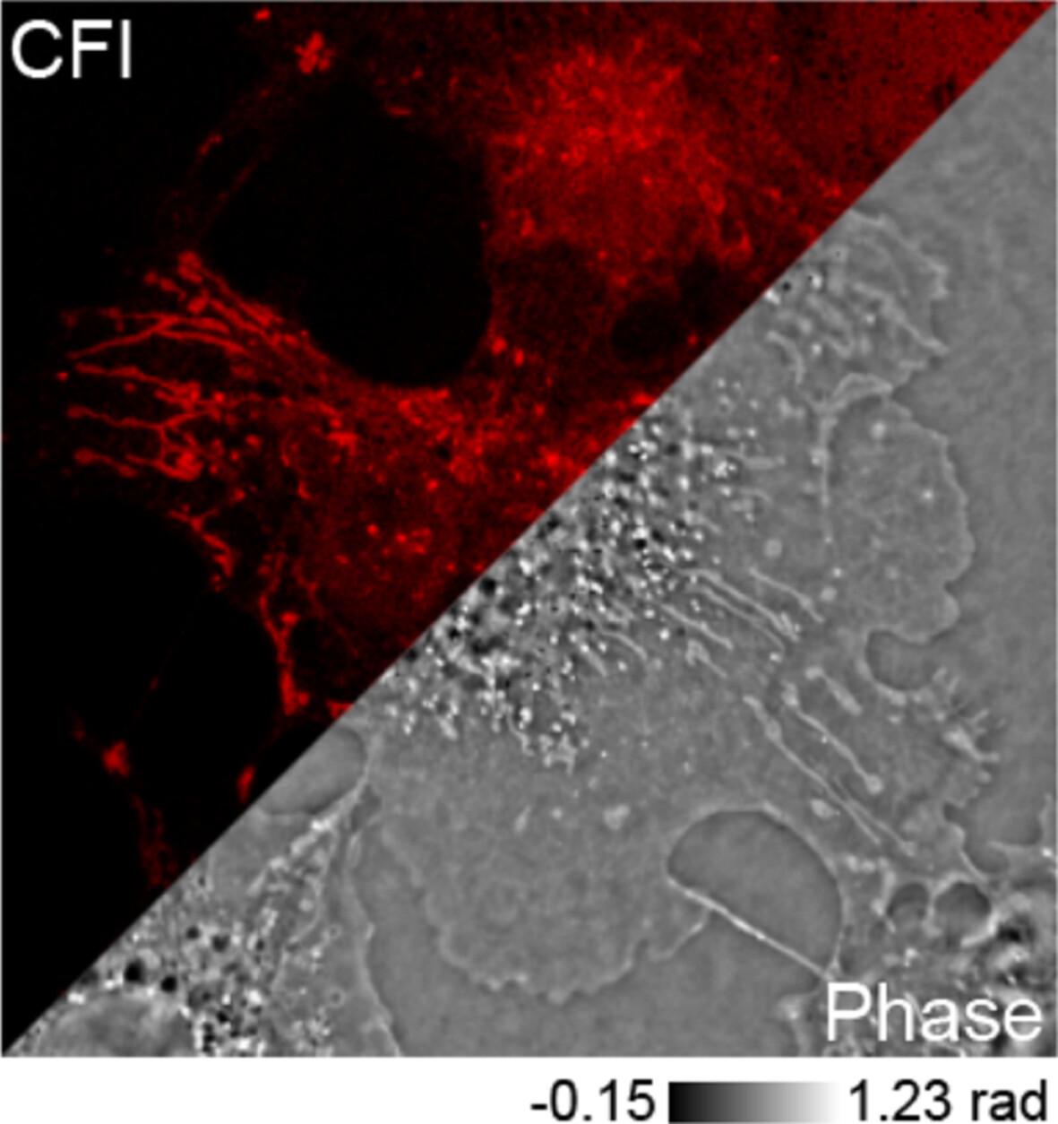 Confocal Laser Scanning Platform Combined With In Situ High-Resolution Quantitative Phase Imaging