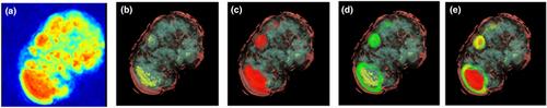 Moderate levels of dissolved iron stimulate cellular growth and increase lipid storage in Symbiodinium sp.
