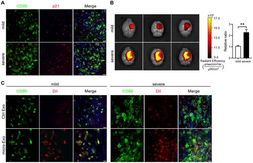 Engineered Exosome-Based Senolytic Therapy Alleviates Stroke by Targeting p21+CD86+ Microglia
