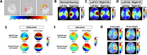 Applications and Challenges of Auditory Brain-Computer Interfaces in Objective Auditory Assessments for Pediatric Cochlear Implants