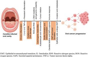 Role of Candida albicans in chronic inflammation and the development of oral squamous cell carcinoma