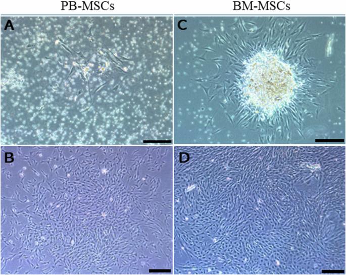 Molecular gene signature of circulating stromal/stem cells