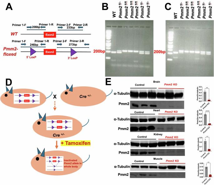 AAV-based gene replacement therapy prevents and halts manifestation of abnormal neurological phenotypes in a novel mouse model of PMM2-CDG