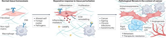 The fibroinflammatory response in cancer