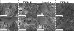 Fabrication and Characterization of Magnesium-Doped Hydroxyapatite Coatings via Solution Precursor Plasma Spraying