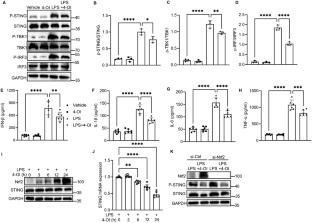Pharmacological inhibition of STING-mediated GPX4 autophagic degradation by 4-octyl itaconate ameliorates sepsis-induced acute kidney injury