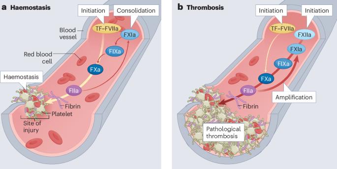 Factor XI inhibitors for the prevention and treatment of venous and arterial thromboembolism