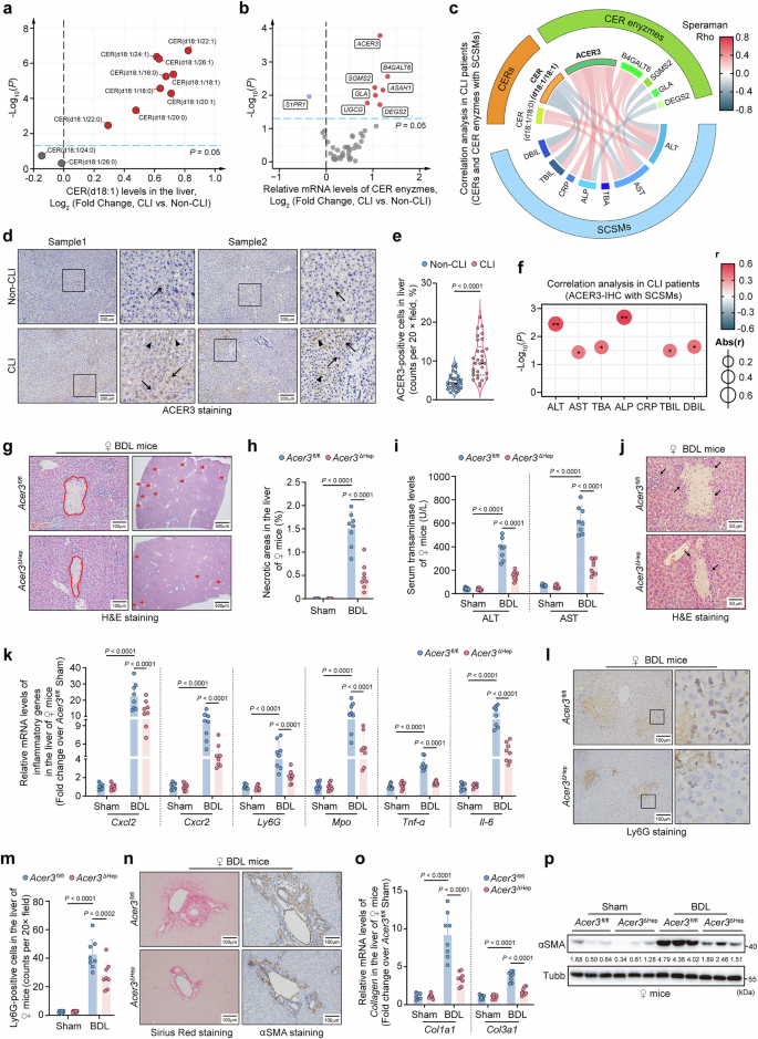 Targeting the ceramidase ACER3 attenuates cholestasis in mice by mitigating bile acid overload via unsaturated ceramide-mediated LXRβ signaling transduction