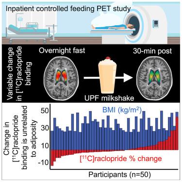 Brain dopamine responses to ultra-processed milkshakes are highly variable and not significantly related to adiposity in humans