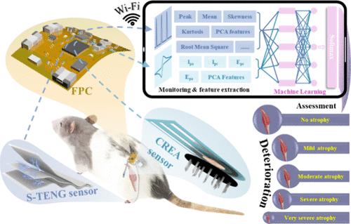 Wireless, Multisensor Integrated Bioelectronics for Real-Time Monitoring and Assessment of Muscle Atrophy