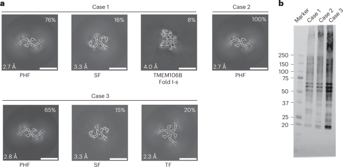 Tau filaments with the Alzheimer fold in human MAPT mutants V337M and R406W