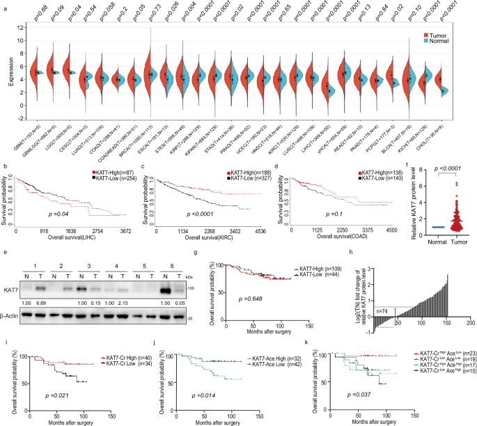 Competitive antagonism of KAT7 crotonylation against acetylation affects procentriole formation and colorectal tumorigenesis