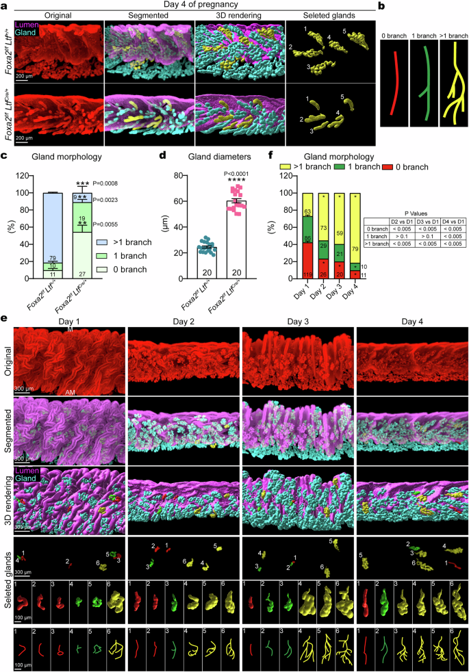 Foxa2-dependent uterine glandular cell differentiation is essential for successful implantation