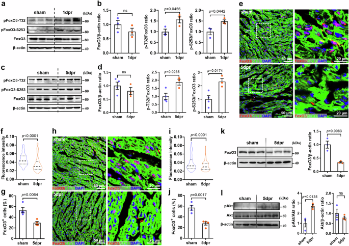 FoxO3 controls cardiomyocyte proliferation and heart regeneration by regulating Sfrp2 expression in postnatal mice
