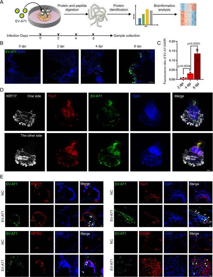 A skin organoid-based infection platform identifies an inhibitor specific for HFMD