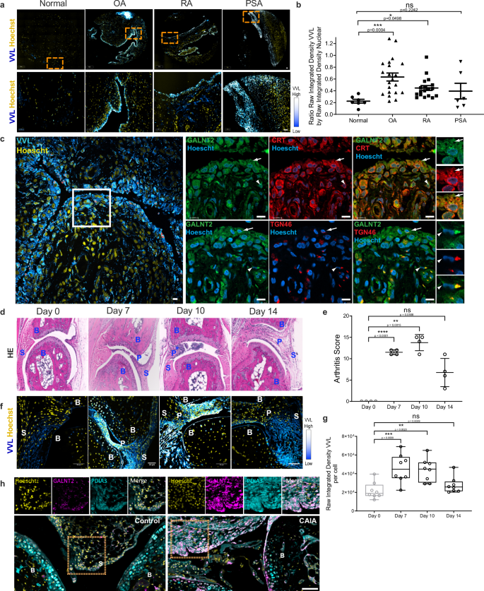 ER O-glycosylation in synovial fibroblasts drives cartilage degradation