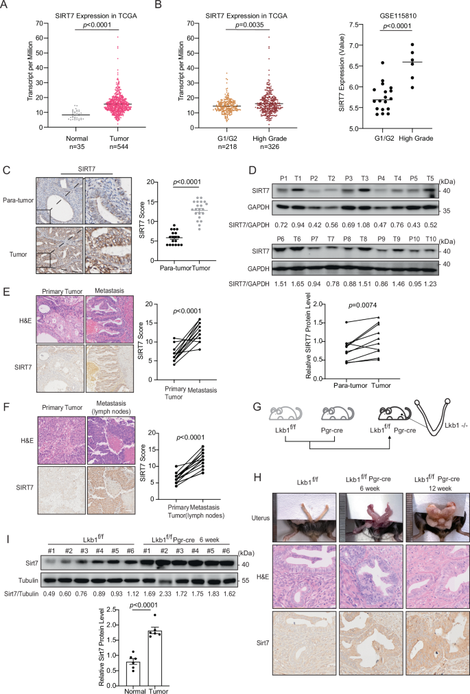 SIRT7 facilitates endometrial cancer progression by regulating PTEN stability in an estrogen-dependent manner