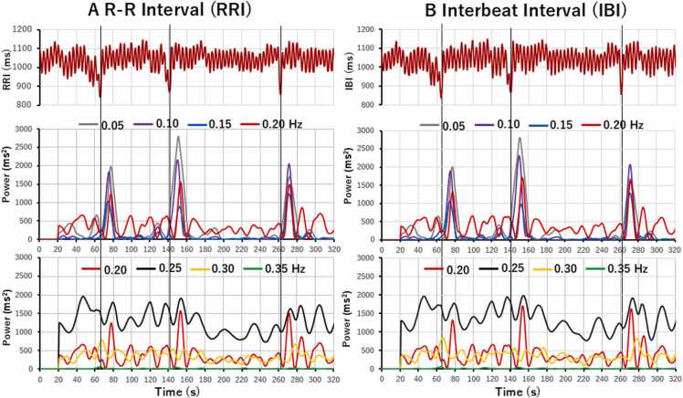 The difference in arterial baroreflex sensitivity between the supine and standing positions in healthy subjects.