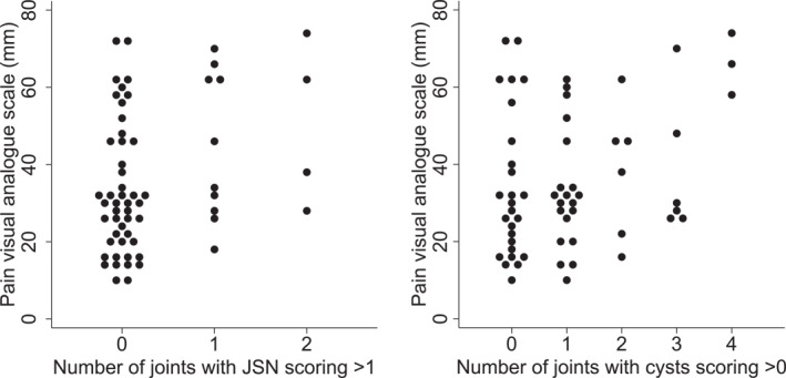Association between clinical and MRI-detected imaging findings for people with midfoot pain, a cross-sectional study.