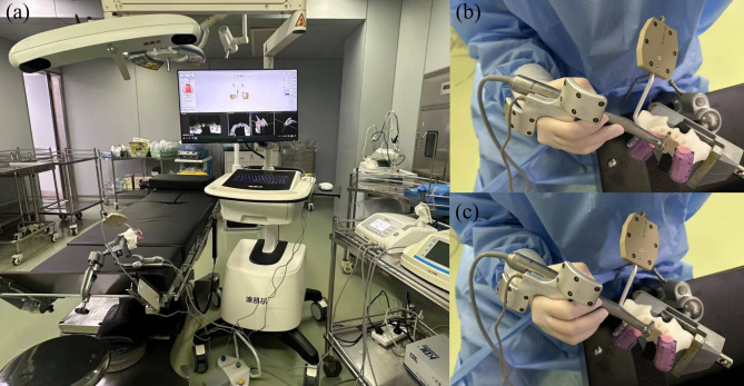 The accuracy of different macrogeometry of dental implant in dynamic navigation guided immediate implant placement in the maxillary aesthetic zone: an in vitro study.