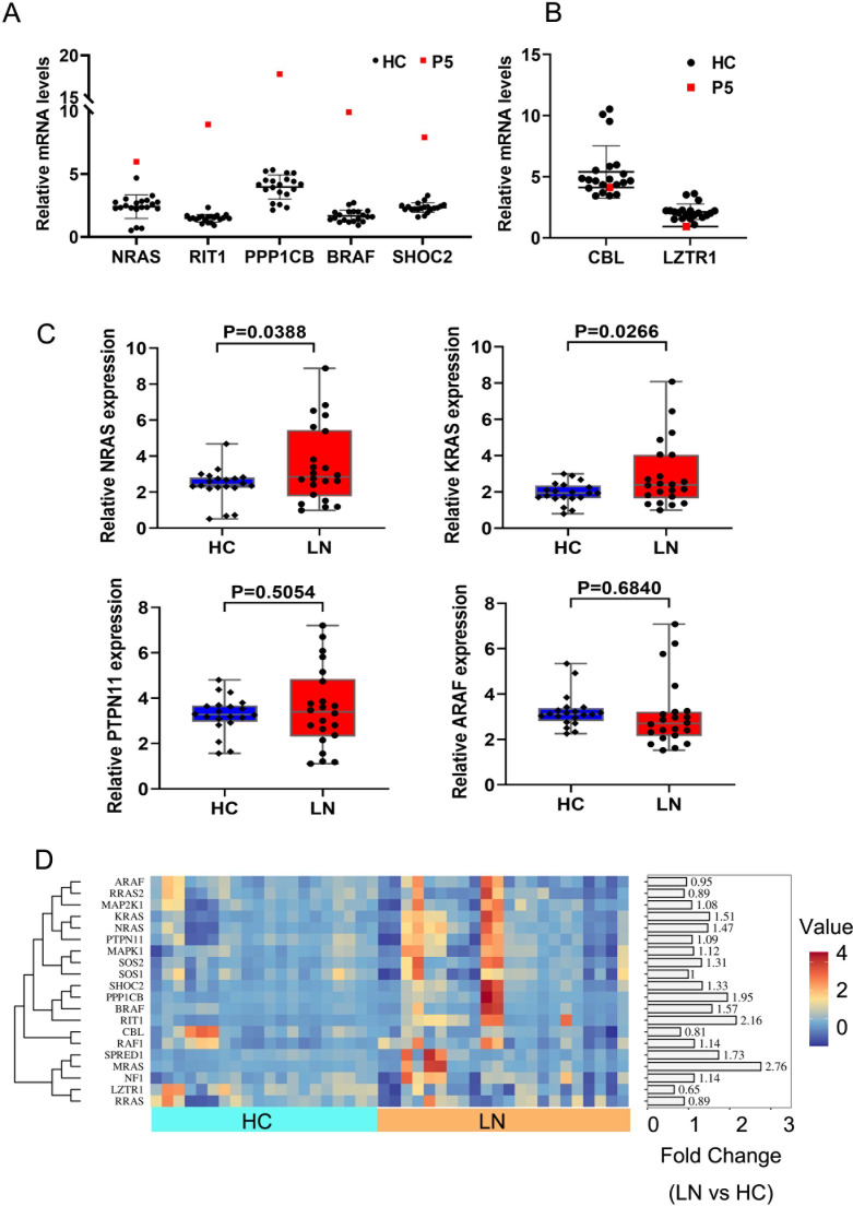 Ras-MAPK pathway in patients with lupus nephritis.