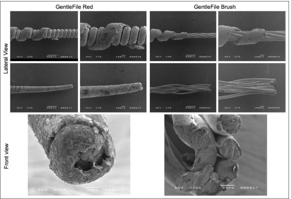 Micro-CT Analysis of an Abrasive-expanding System of Oval Canal Debridement Capacity: Laboratory Study.